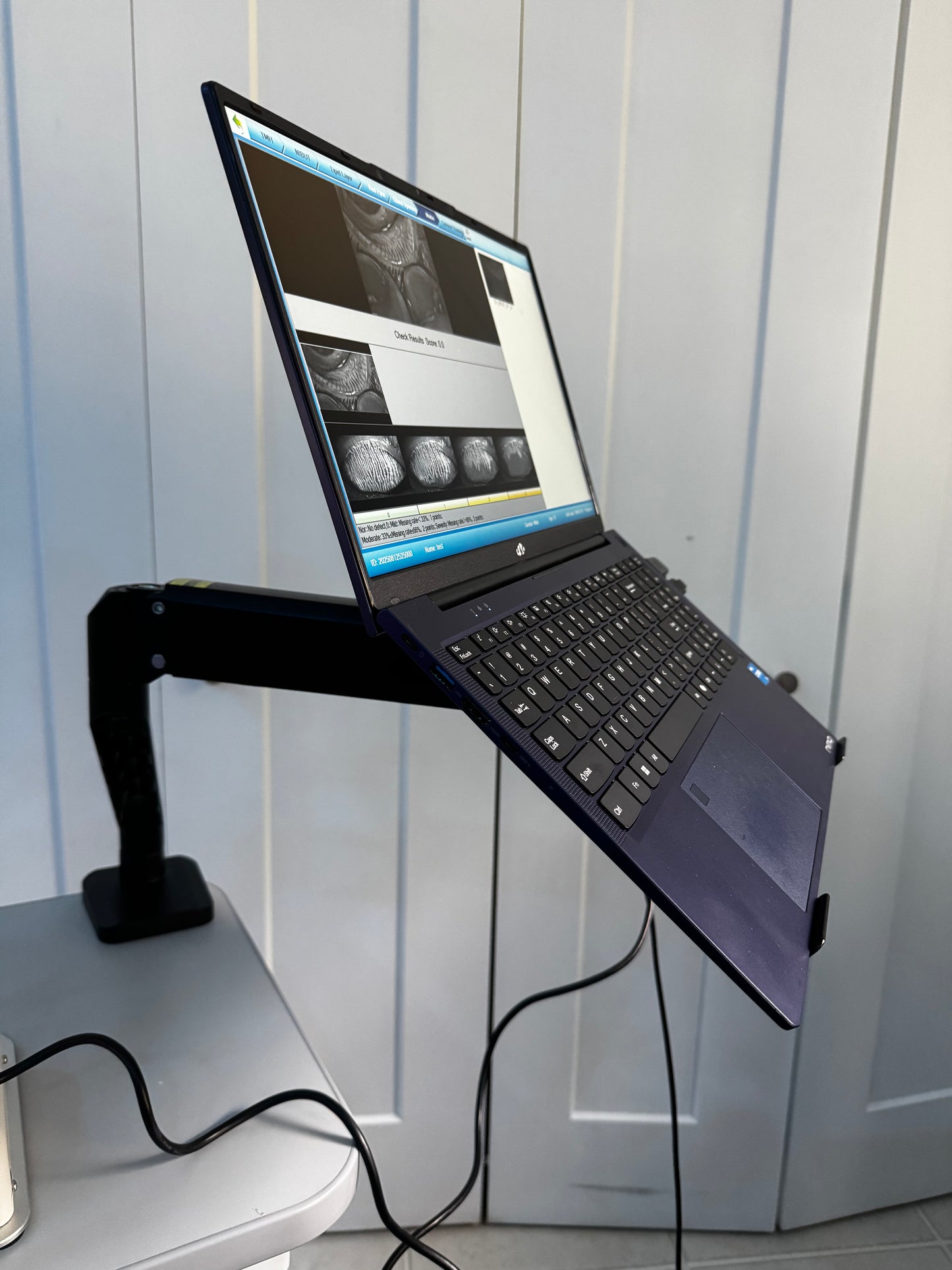 DA-2 Dry Eye Analyzer