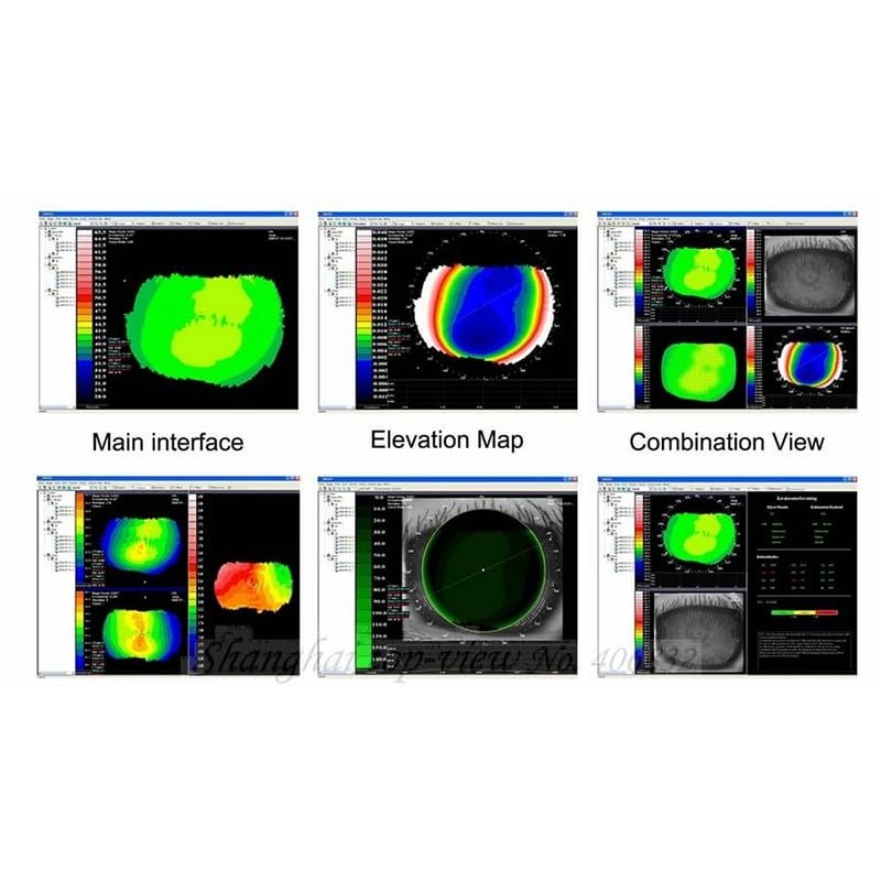 OcuRx SW-6000 corneal topographer showing precise Placido-based corneal mapping with 31 rings and 7,936 measurement points for advanced eye care diagnostics