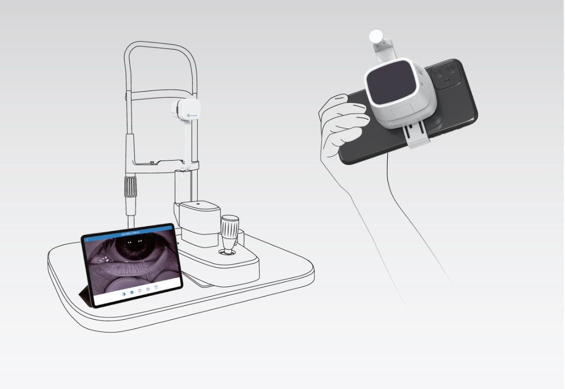 MeiboVue Plus Portable Meibographer - OcuRx