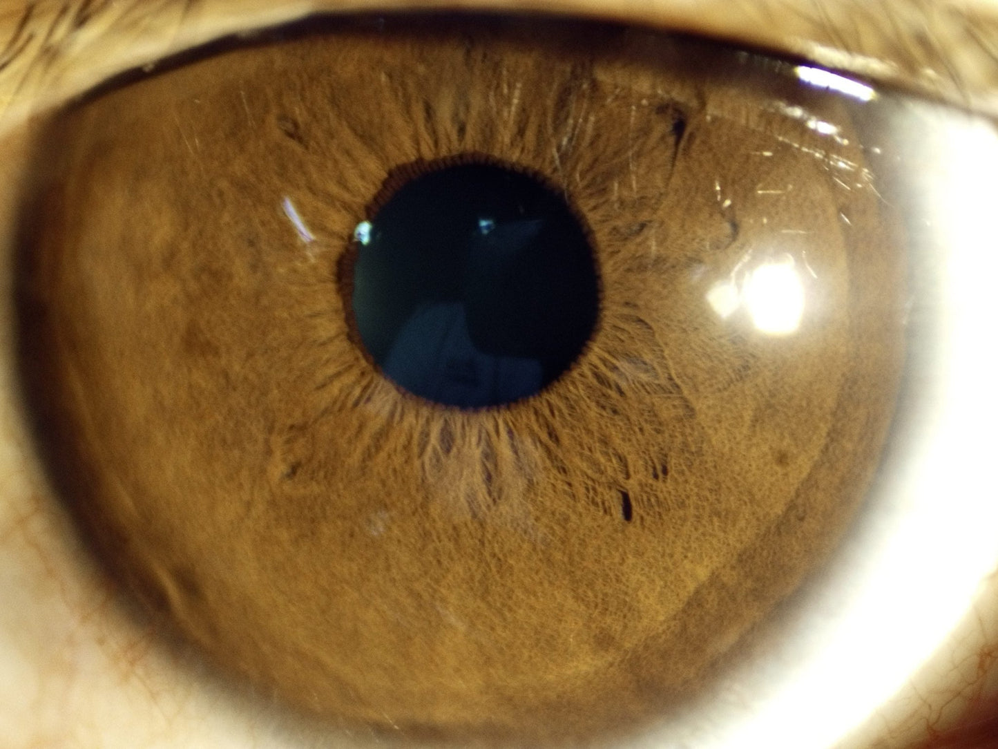 OcuRx Digital Slit Lamp - OcuRx