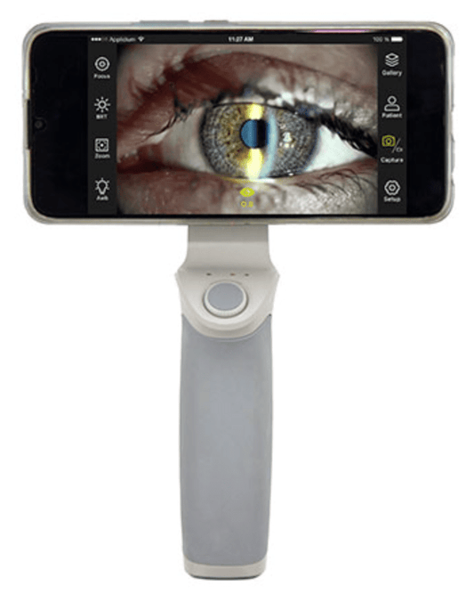 OcuRx PSL - 150 Portable Digital Slit Lamp - OcuRx