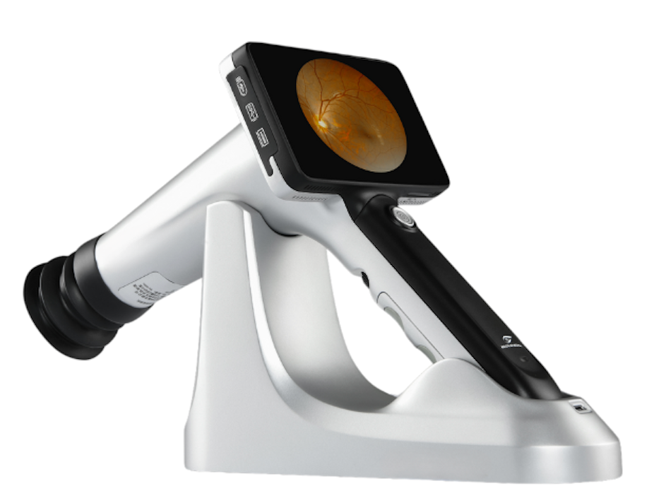 OcuRx Portable Fundus Camera