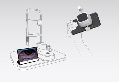 MeiboVue Plus Portable Meibographer - OcuRx