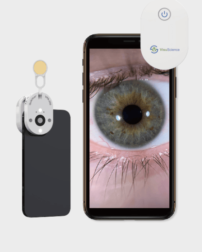 MeiboVue/QuikVue + 3 Dry - Eye Masks - OcuRx
