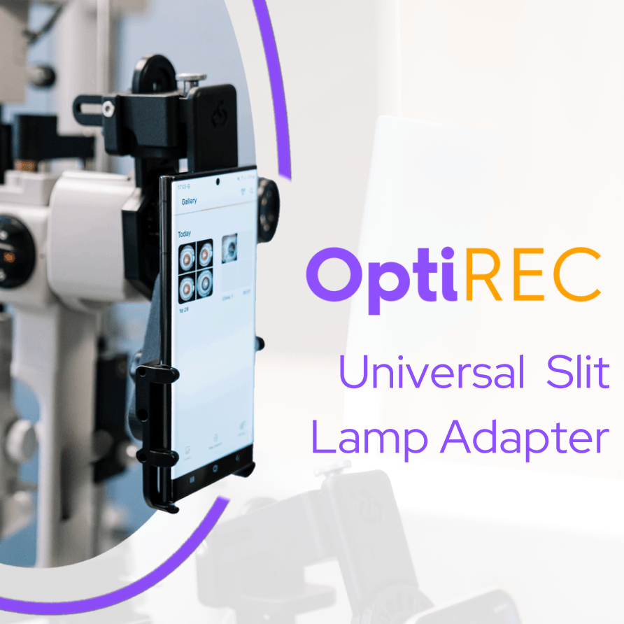 OptiRec - Slit Lamp Adapter - OcuRx
